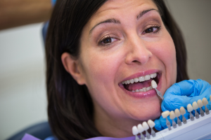permanent dental implants